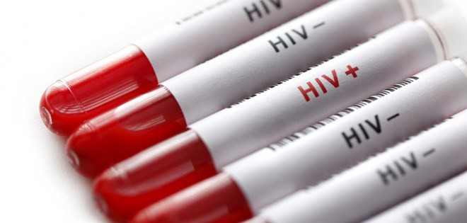 Vietnam keeps rate of new HIV cases lower 0.3 percent ảnh 1