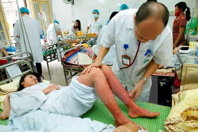 Dengue fever treatment remains weak: official ảnh 1 Dengue fever treatment remains weak: official ảnh 1