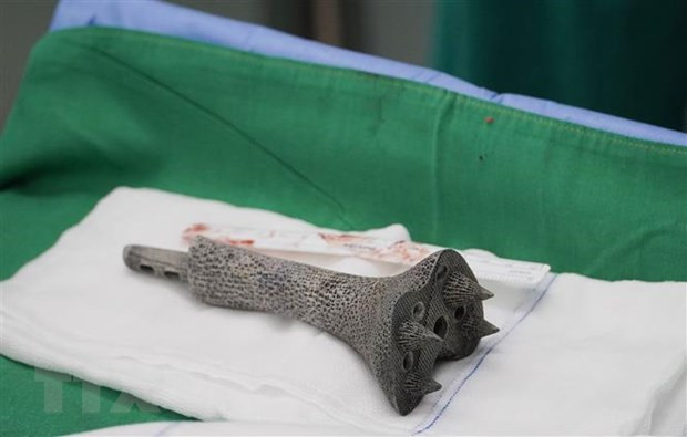 Cho Ray Hospital successfully applies new technique in bone surgery ảnh 1 Cho Ray Hospital successfully applies new technique in bone surgery ảnh 1