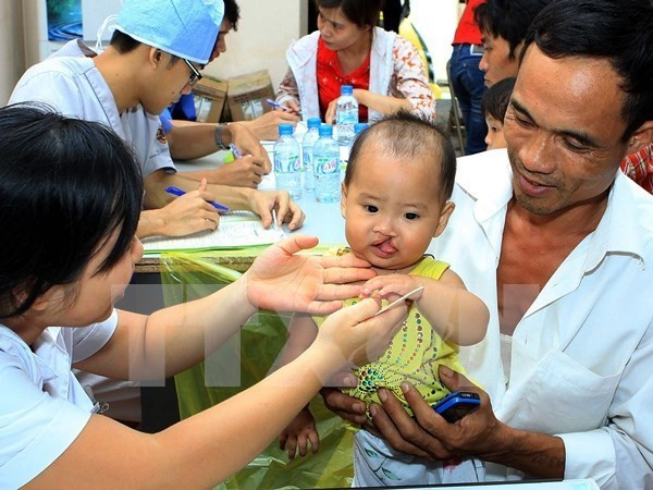 Free surgeries offered for cleft palate patients in Thua Thien-Hue ảnh 1