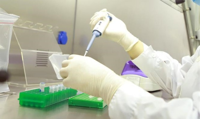 Additional 3,943 COVID-19 cases take national count to over 181,000 ảnh 1