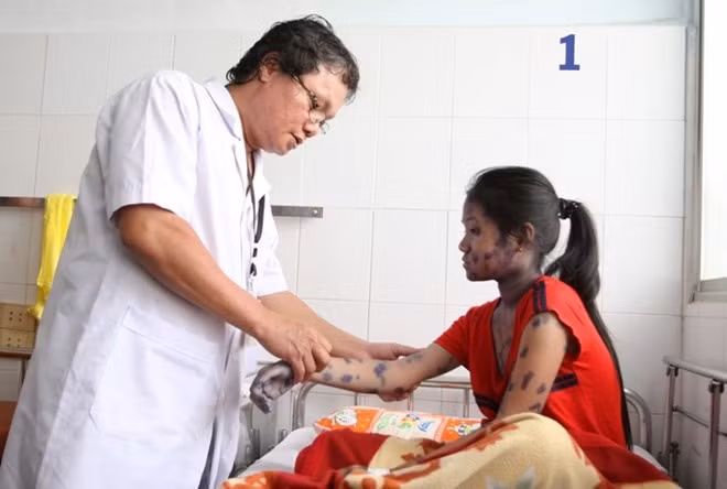 Southern region sees more chickenpox cases ảnh 1
