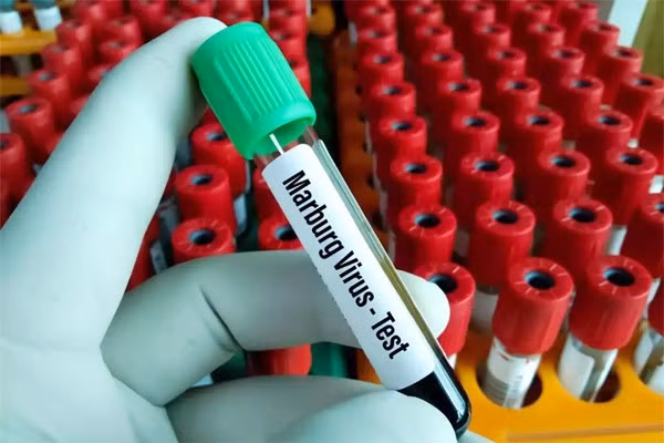 Ministry urges prevention of Marburg virus from entering Vietnam ảnh 1