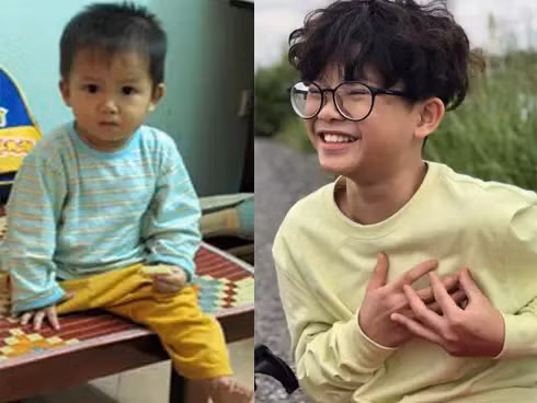Italian surgeons’ book inspired by Miracle Boy Thien Nhan ảnh 4