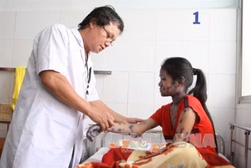 HCM City warns against chicken-pox outbreaks ảnh 1