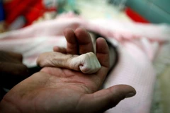 Vietnam calls for efforts to tackle hunger in Yemen