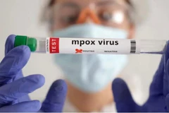 Singapore puts precautionary measures in place to prevent mpox