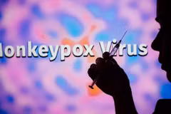 No monkeypox cases recorded in Vietnam so far: Foreign Ministry