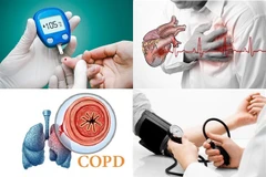 Public awareness key to reducing risks associated with NCDs