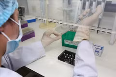 Health Ministry receives 10,000 COVID-19 test kits
