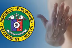 The Philippines reports more Mpox cases (Photo: asianews.network)