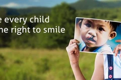 Free cleft lip, palate surgeries for ethnic minority children 