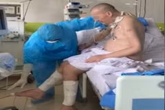 Most severe Covid-19 patient shows impressive recovery