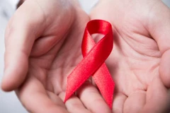 HIV/AIDS model launched in Hanoi