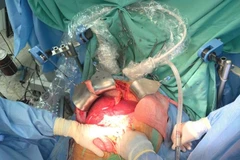 Hue Central Hospital performs record number of organ transplants