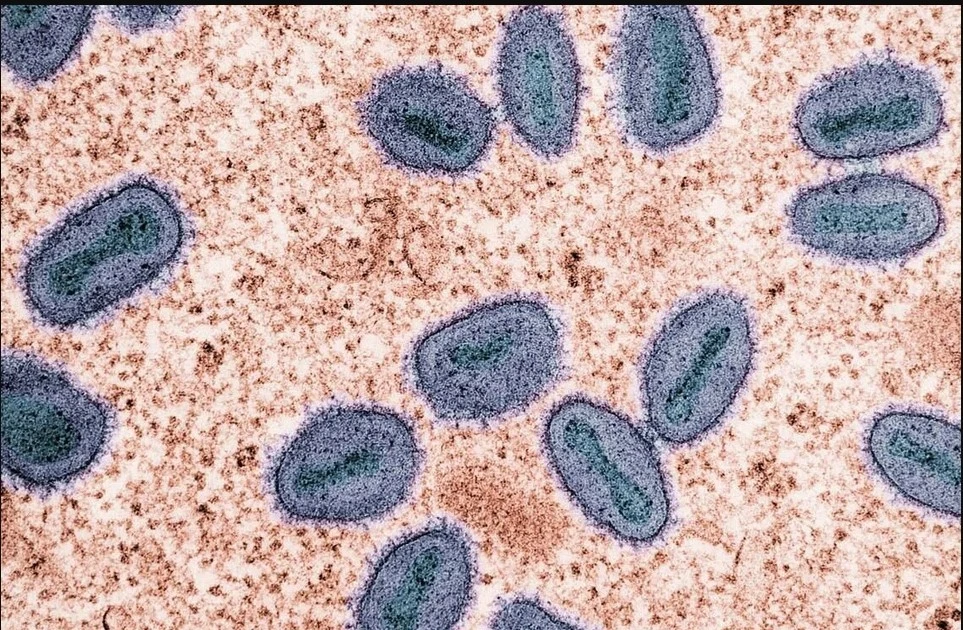 Singapore reports first community mpox cases
