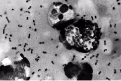 The bacterium Yersinia pestis causes plague, with bubonic plague being the most common form. Photo: US Centres for Disease Control and Prevention (CDC)