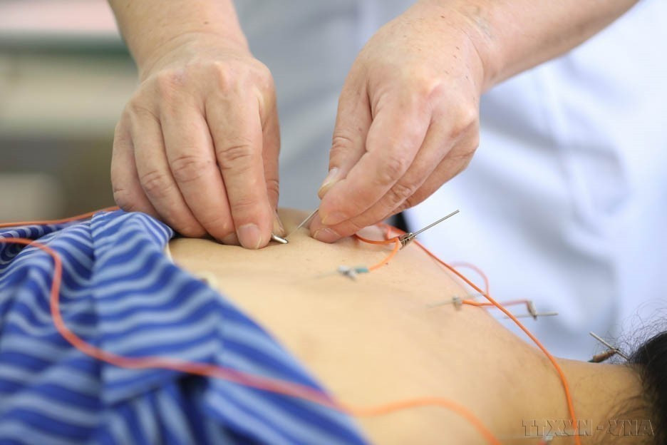 Electroacupuncture method is used to treat patients at Lang Son Provincial Hospital of Traditional Medicine. (Photo: VNA)