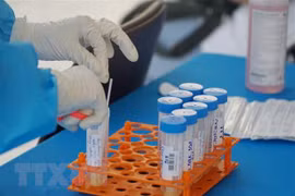 Additional 260 COVID-19 infections recorded on July 4 morning 