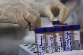81 new COVID-19 cases confirmed on June 18 early morning 