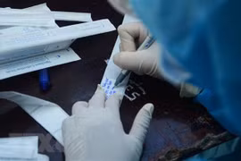 COVID-19: Additional 48 cases detected on May 18 afternoon