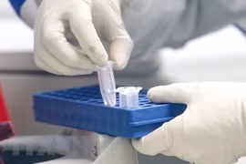 Hanoi collects COVID-19 testing samples related to Japanese patient