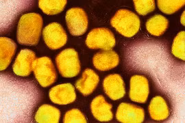 Indonesia works to tackle risk of monkeypox outbreak