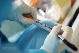 About 30 labs in Vietnam capable of testing for COVID-19