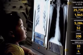 Malaysia worries over return of infectious diseases 
