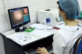 HPV test recommended as primary test in cervical cancer screening