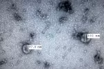 Vietnam successfully isolates new coronavirus: health official
