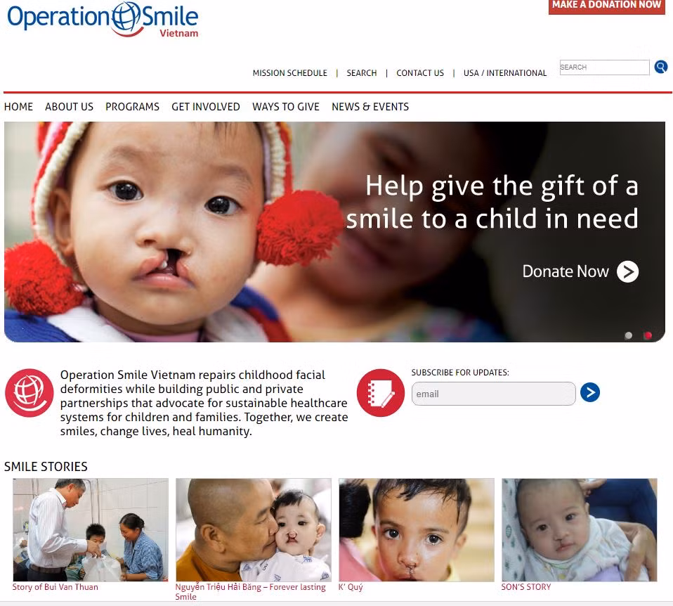 Central Highlands children with cleft lip, palate get free operations ảnh 1