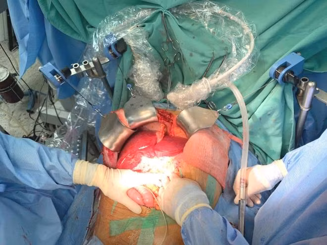 Hue Central Hospital performs record number of organ transplants ảnh 1